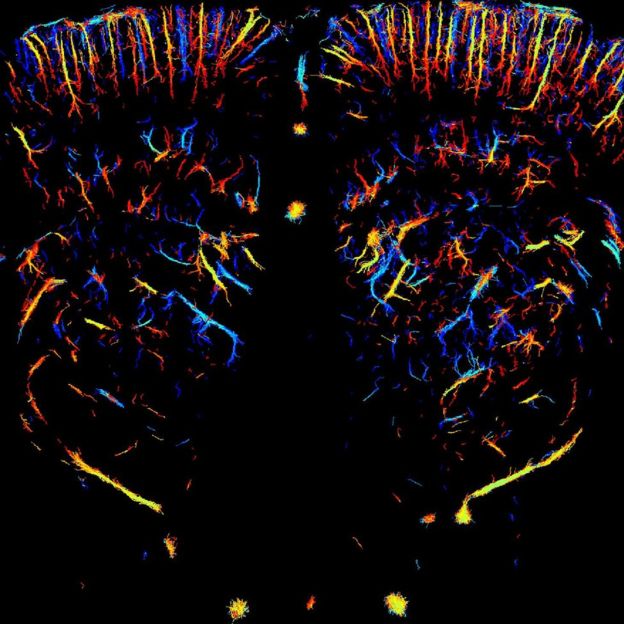 Rat Brain Art