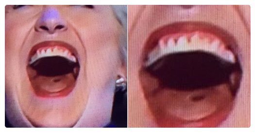 hillary-neck-2