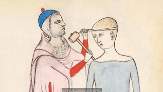 trepan