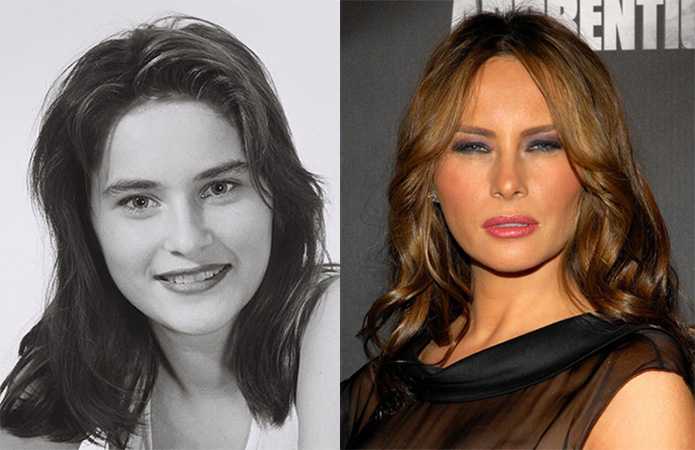 melania-too-much-filler_2016-05-27_04-59-06