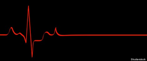 flatline