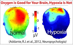 hypoxia