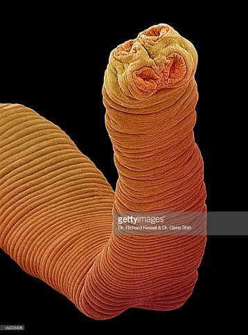 tapeworm